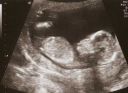 Heather_12_weeks.jpg