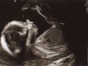 Heather_20_weeks.jpg